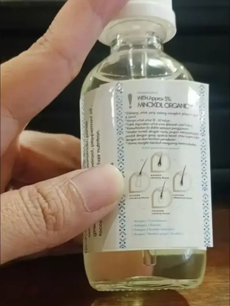 SOLUSI KEBOTAKAN RAMBUT MINOXIDIL 5% - Other in Bali