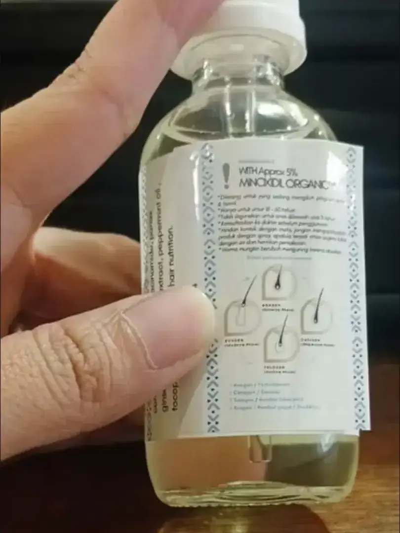 SOLUSI KEBOTAKAN RAMBUT MINOXIDIL 5% - Image 1 of 3
